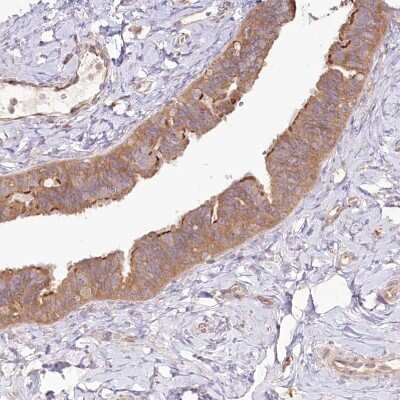 Immunohistochemistry-Paraffin: TNIP1 Antibody [NBP1-89306]