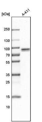 Western Blot: TNIP1 Antibody [NBP1-89306]