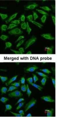 Immunocytochemistry/ Immunofluorescence: TNIP2 Antibody [NBP1-32689]