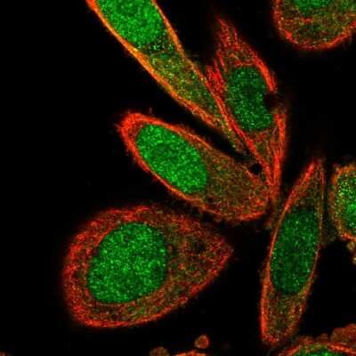 Immunocytochemistry/ Immunofluorescence: TNIP2 Antibody [NBP2-48949]