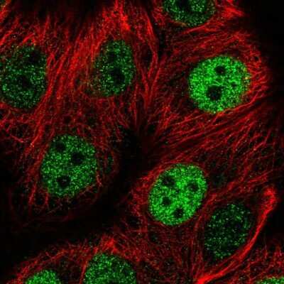 Immunocytochemistry/ Immunofluorescence: TNIP2 Antibody [NBP2-49389]