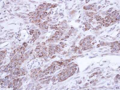 Immunohistochemistry-Paraffin: TNIP2 Antibody [NBP1-32689]
