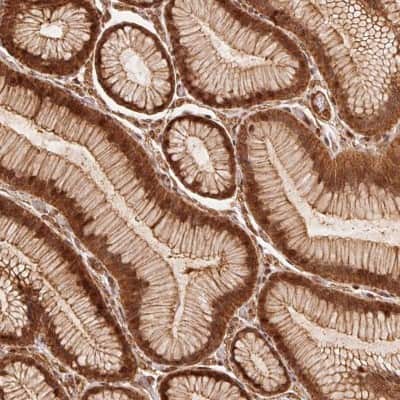 Immunohistochemistry-Paraffin: TNIP2 Antibody [NBP2-49389]