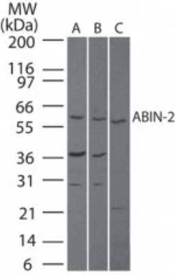 Western Blot: TNIP2 Antibody [NB100-56701]