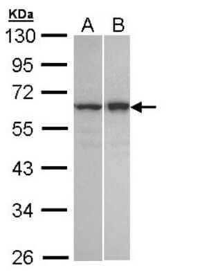 Western Blot: TNIP2 Antibody [NBP1-32689]