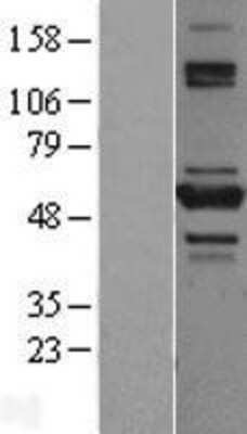 Western Blot: TNIP2 Overexpression Lysate [NBL1-17173]