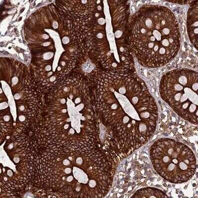 Immunohistochemistry-Paraffin: TNIP3 Antibody [NBP1-89305]