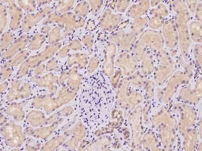 Immunohistochemistry-Paraffin: TNIP3 Antibody [NBP2-97865]