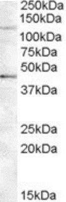 Western Blot: TNKS2 Antibody [NBP1-28497]