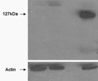 Western Blot: TNKS2 Antibody [NBP1-36993]