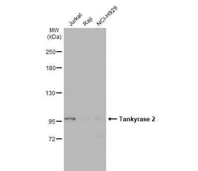 Western Blot: TNKS2 Antibody [NBP2-20675]