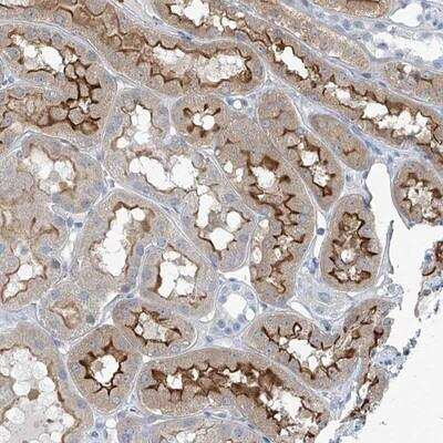 Immunohistochemistry-Paraffin: TNN Antibody [NBP1-91049]