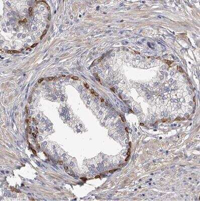 Immunohistochemistry-Paraffin: TNN Antibody [NBP1-91048]