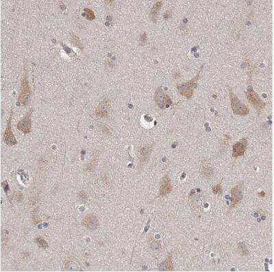 Immunohistochemistry-Paraffin: TNN Antibody [NBP1-91048]