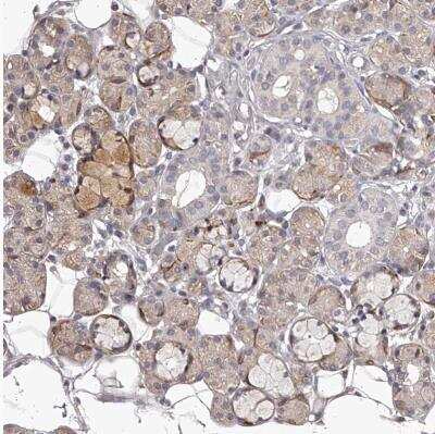 Immunohistochemistry-Paraffin: TNN Antibody [NBP1-91048]