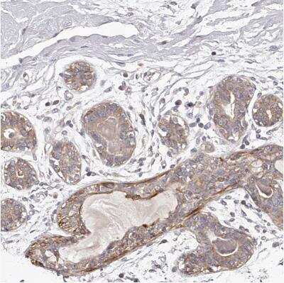 Immunohistochemistry-Paraffin: TNN Antibody [NBP1-91048]