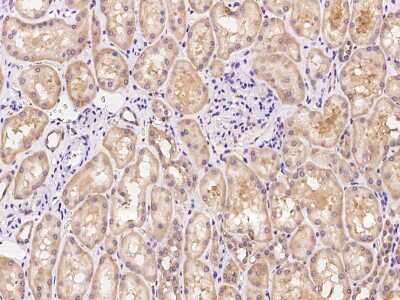 Immunohistochemistry-Paraffin: TNN Antibody [NBP2-98639]