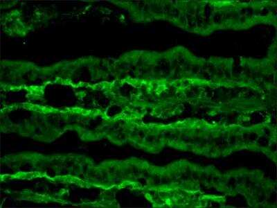 Immunohistochemistry-Frozen: TNN Antibody (MTn-12) [NBP3-08210]