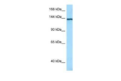 Western Blot: TNN Antibody [NBP2-85966]