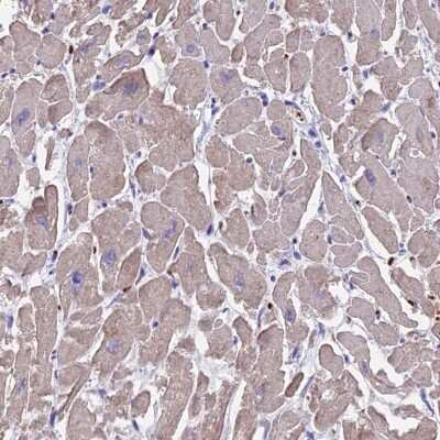 Immunohistochemistry-Paraffin: TNNC2 Antibody [NBP1-86205]