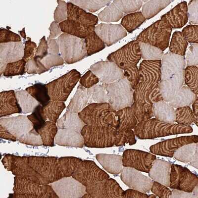 Immunohistochemistry-Paraffin: TNNC2 Antibody [NBP1-86205]