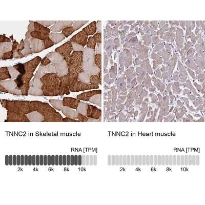Immunohistochemistry-Paraffin: TNNC2 Antibody [NBP1-86205]
