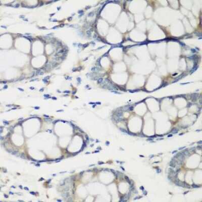 Immunohistochemistry-Paraffin: TNNC2 Antibody - BSA Free [NBP2-93498]