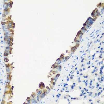 Immunohistochemistry-Paraffin: TNNC2 Antibody - BSA Free [NBP2-93498]