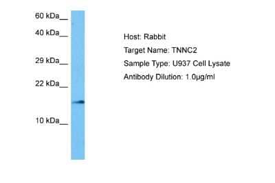 Western Blot: TNNC2 Antibody [NBP2-85968]