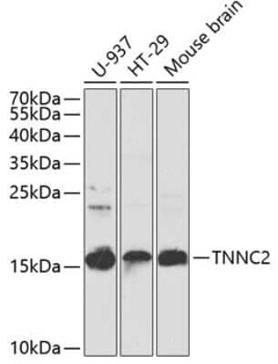 Western Blot: TNNC2 AntibodyBSA Free [NBP2-93498]