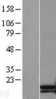 Western Blot: TNNC2 Overexpression Lysate [NBL1-17177]