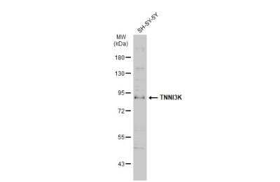 Western Blot: TNNI3K Antibody [NBP1-32837]