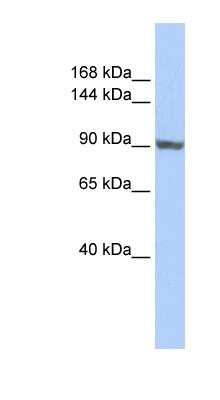 Western Blot: TNNI3K Antibody [NBP1-57841]