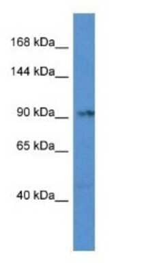 Western Blot: TNNI3K Antibody [NBP1-79279]