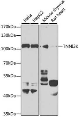 Western Blot: TNNI3K AntibodyBSA Free [NBP2-94172]