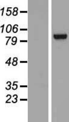 Western Blot: TNNI3K Overexpression Lysate [NBP2-07101]