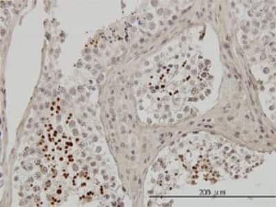 Immunohistochemistry-Paraffin: TNP1 Antibody (1B5) [H00007141-M01]