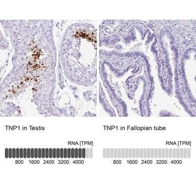 Immunohistochemistry-Paraffin: TNP1 Antibody [NBP2-30567]