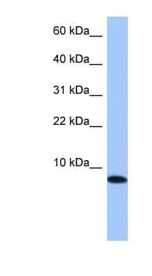 Western Blot: TNP1 Antibody [NBP1-55356]