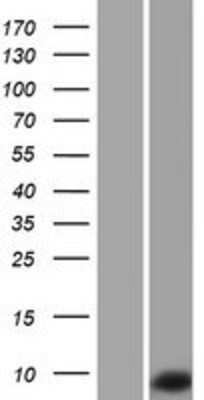 Western Blot: TNP1 Overexpression Lysate [NBP2-08023]