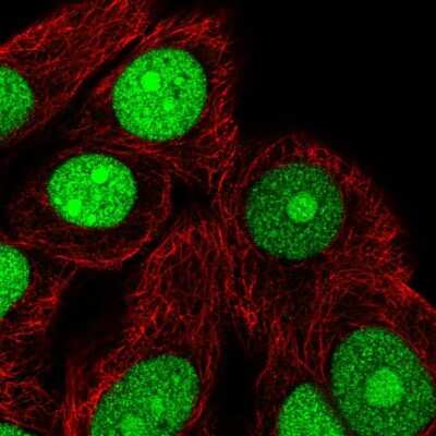 Immunocytochemistry/ Immunofluorescence: TNPO2 Antibody [NBP2-57553]