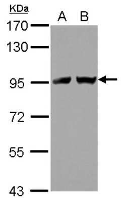 Western Blot: TNPO2 Antibody [NBP2-20676]