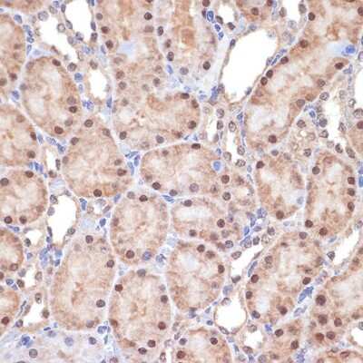 Immunohistochemistry-Paraffin: TNPO3 Antibody (0U3Q1) [NBP3-15908]
