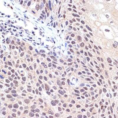 Immunohistochemistry-Paraffin: TNPO3 Antibody (0U3Q1) [NBP3-15908]