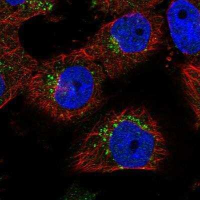 Immunocytochemistry/ Immunofluorescence: TNPO3 Antibody [NBP1-81585]