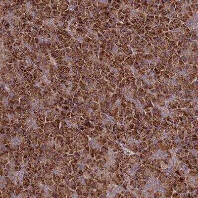 Immunohistochemistry-Paraffin: TNPO3 Antibody [NBP1-81585]