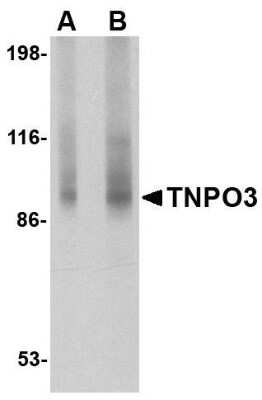 Western Blot: TNPO3 AntibodyBSA Free [NBP1-76374]