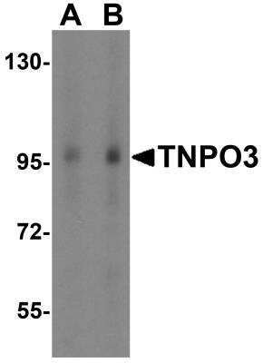 Western Blot: TNPO3 AntibodyBSA Free [NBP1-76374]