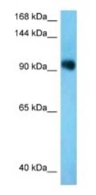 Western Blot: TNPO3 Antibody [NBP3-09466]