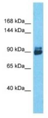 Western Blot: TNPO3 Antibody [NBP3-09932]